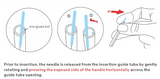 Unisharp™ KL-Type Acupuncture Needles (1 Needle/Tube, 200 PCS/Box) NO TAB